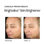 9083a73c Da4e 4ed9 9f72 A0fd543f46b0